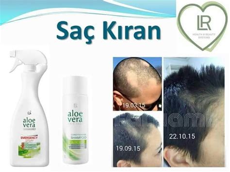 Saç Kırana Ne Iyi Gelir – mytimeplus.net