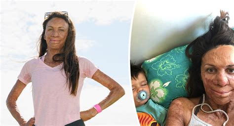 Turia Pitt Sparks Movement To Help Businesses In Bushfire Areas New