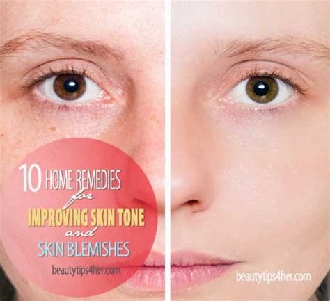 🌟 10 Home Remedies For Improving Skin Tone And Blemishes 🌟 Improve