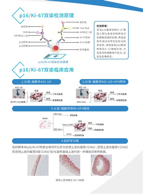 新品上市 百凌生物p16ki 67双染检测试剂盒 杭州百凌生物科技有限公司 官方网站