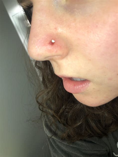 what should i do my nose piercing looks like this it s purple ish and 3 months old r piercing