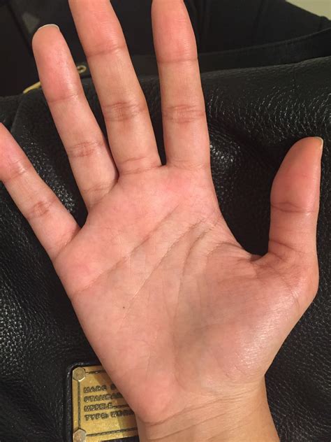 I got this brand new beauty mark appear out of nowhere on top of my