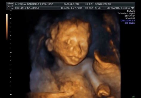 20 Week 4d Ultrasound Of Our Baby Girl Genesis Faith