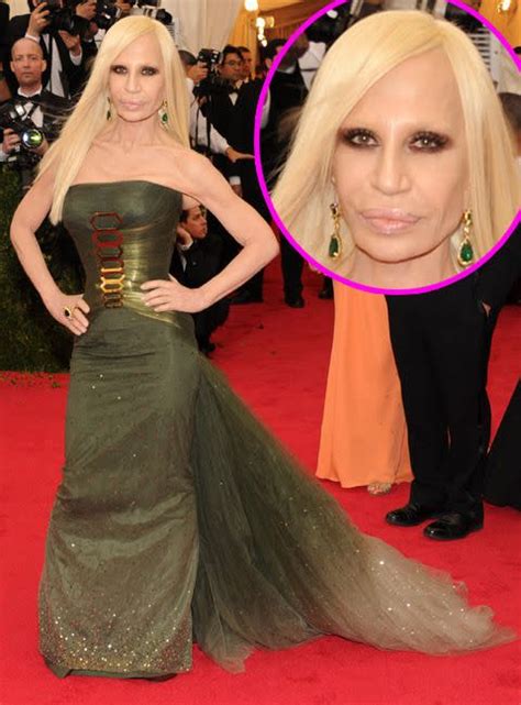 What Happened To Donatella Versace S Face
