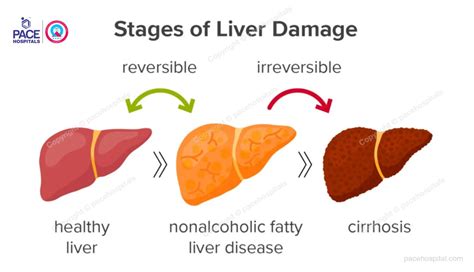 Non Alcoholic Fatty Liver Disease Nafld Causes And Symptoms