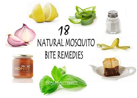 Remedies For Mosquito Bites Natural Mosquito Bite