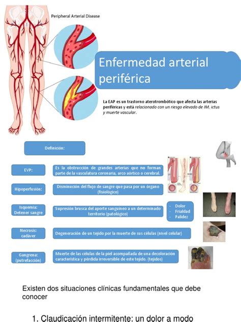 Enfermedad Arterial Periferica Pdf Especialidades Medicas Sistema