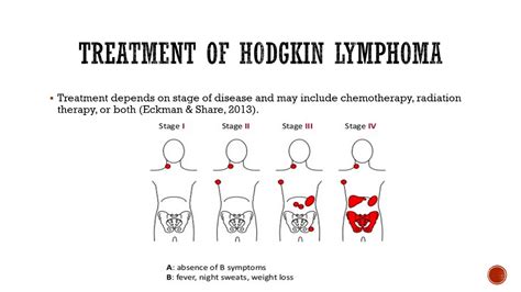 Hodgkin Lymphoma Presentation 2 Youtube