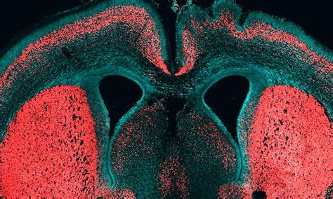 Single gene that made us more intelligent than chimps is identified for