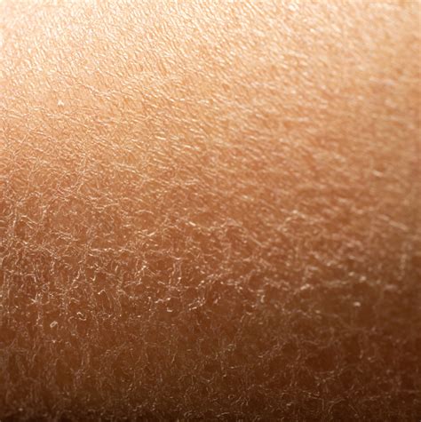 Crepey Skin A Comprehensive Guide Khus