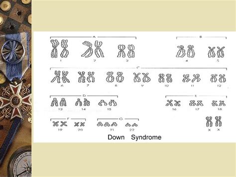 Ppt Trisomy 21 Down Syndrome Powerpoint Presentation Id73671