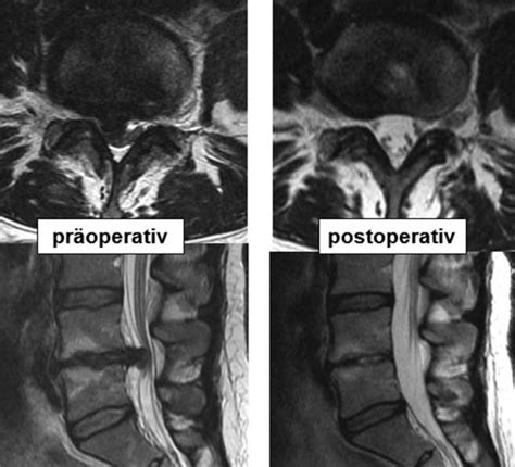Die erkrankung osteochondrose hat viele gesichter: Prof. Dr. Christian Woiciechowsky - Neurochirurgie Berlin ...