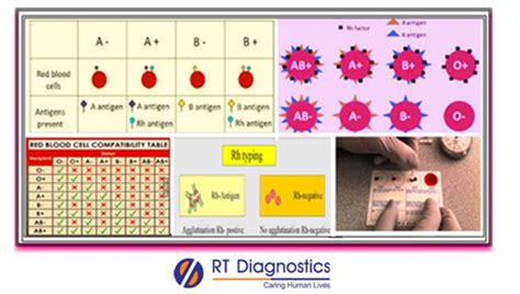 Blood Group And Rh Typing Rt Diagnostics