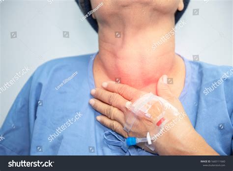 Enlarged Multinodular Thyroid Goiter Middleaged Asian Stok Fotoğrafı