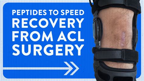 Peptides To Speed Recovery From Acl Surgery Dr Geier