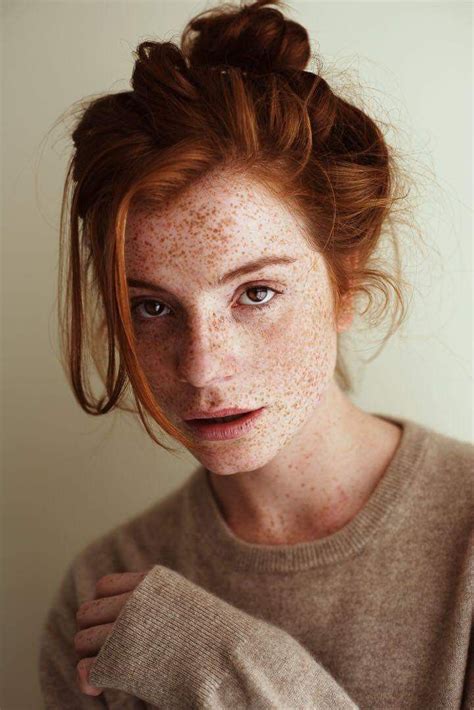 A Woman With Freckles On Her Face Is Looking At The Camera And Has Red Hair