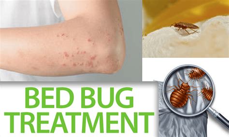 Facts You Need Know About The Bed Bug Treatment By Hello Pestcontrol