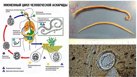 Description And Photos Of Roundworm Features Of The Structure