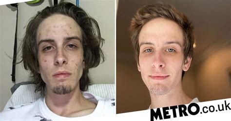 drug addict posts inspiring before and after photos to celebrate recovery metro news