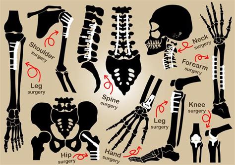 Human Arm Skeletal Anatomy Diagram 1166070 Vector Art At Vecteezy