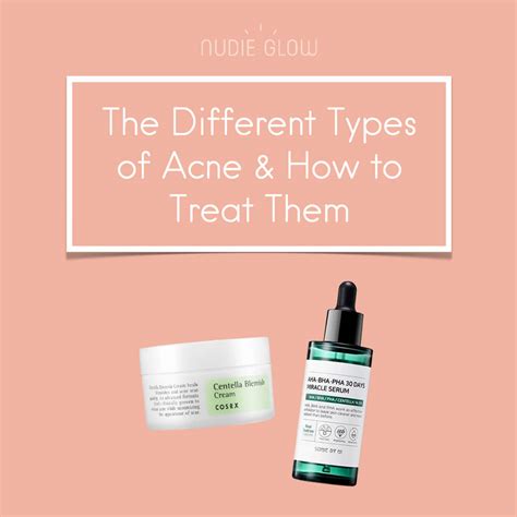 What Type Of Acne Do You Have The Different Types Of Acne And How T