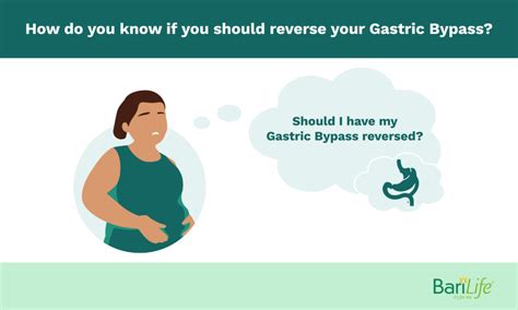 Gastric Bypass Reversal What Happens After Its Reversed