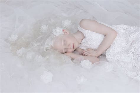 Albinism Photographs Yulia Taits Popsugar Beauty