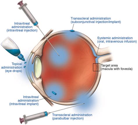 Jci Recent Developments In The Treatment Of Age Related Macular