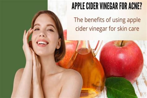 Apple Cider Vinegar For Acne The Benefits Of Using Apple Cider Vinegar