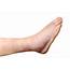 Edema Causes Symptoms And Treatments  Medical News Today