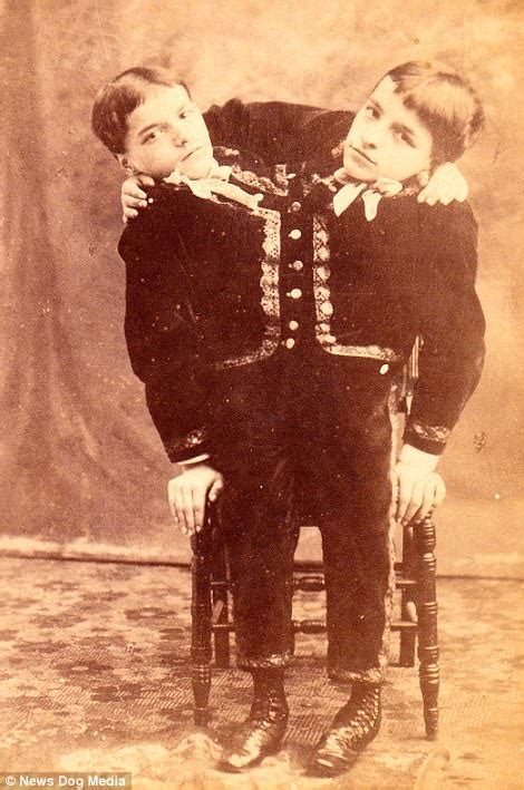 Stars Of 19th Century Freak Shows In The Us Are Revealed Daily Mail