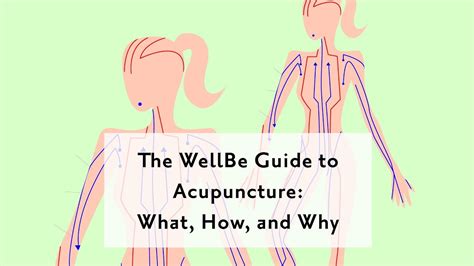 The Acupuncture Facts You Need To Know History Benefits Process And