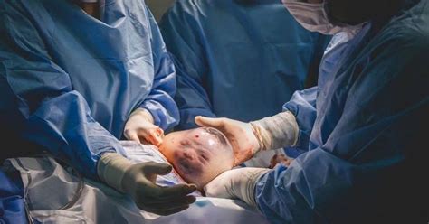 Photo Captures Stunning Images From A Birth That Only Happens Once In
