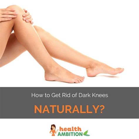 How To Get Rid Of Dark Knees Easily And Naturally Perfect Skin