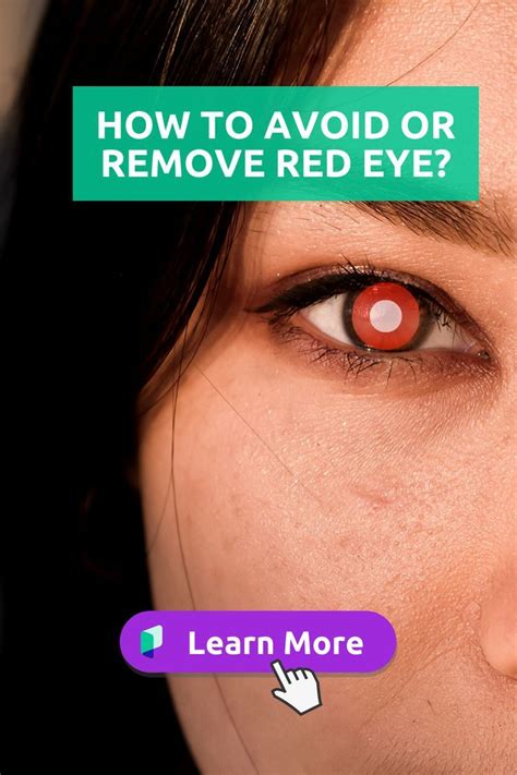 How To Avoid Or Remove Red Eye Eyes Red Eyes How To Take Photos