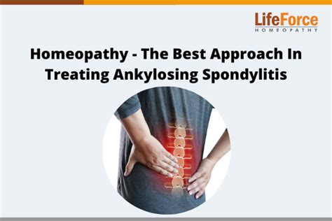 Homeopathy The Best Approach In Treating Ankylosing Spondylitis