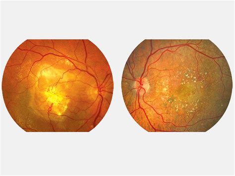 Simple Science: How to Make a Volcano with Kids