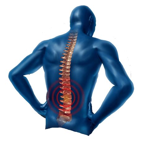 Pain In The Neck Png Transparent Image Png Mart