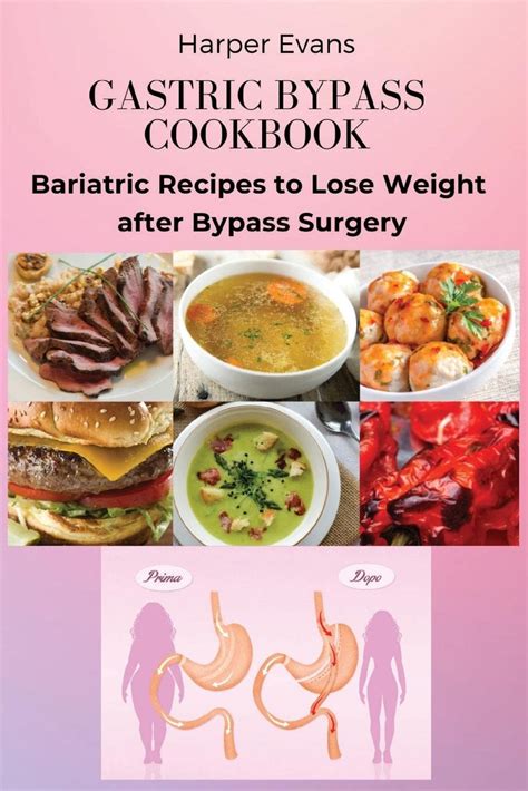 Gastric Bypass Cookbook Bariatric Recipes To Lose Weight After Bypass Surgery By Harper Evans