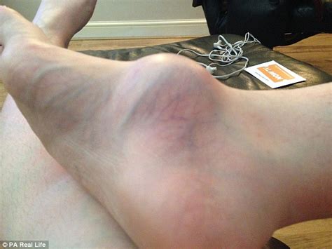 Woman Visits Doctor To Discuss Swollen Foot Gets Biggest Surprise Of Her Life Photos