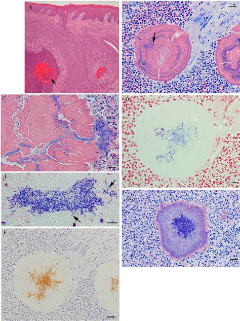 Histology And Immunohistochemistry Of Granulation Tissues A A Large