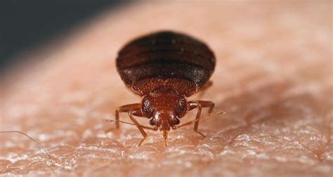 Bed Bug Bites Symptoms Prevention And Treatment