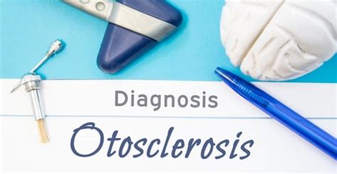 10 Symptoms And Treatments Of Otosclerosis Facty Health