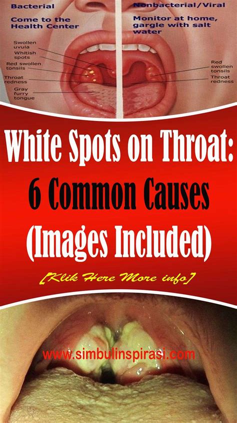 Can Cancer Cause White Spots On Skin Printable Templates Protal