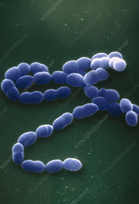 Streptococcus Pneumoniae Bacteria SEM Stock Image B236 0131
