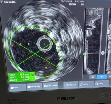 Varicose Comprehensive Vein Center Symmetry Vascular