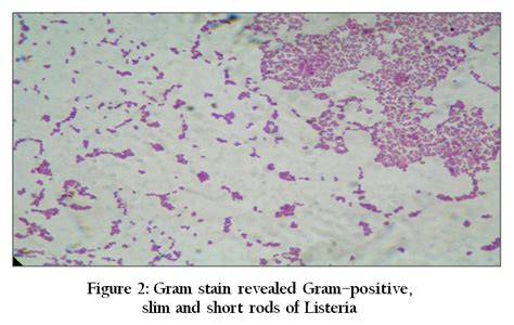 Image of a gram stain prepared from an 18 hour old broth culture. Listeria Meningitis