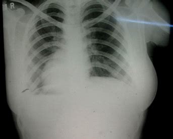 Heart | Applied Anatomy