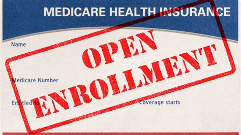 Medicare Open Enrollment Starts Now What You Need To Know Kiplinger