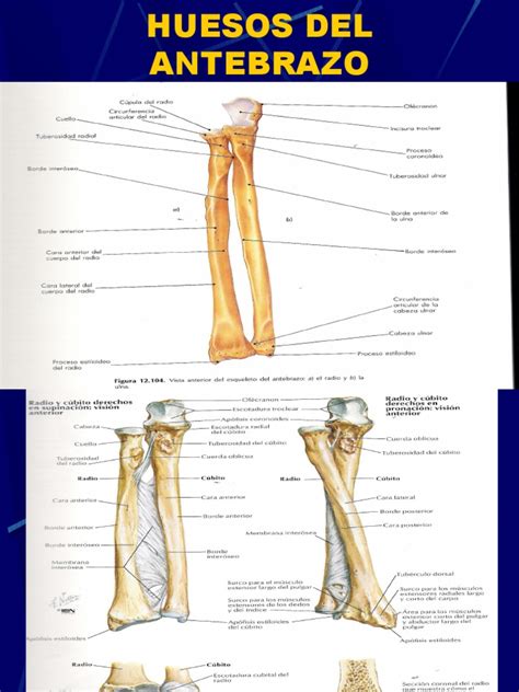 Huesos Del Antebrazo